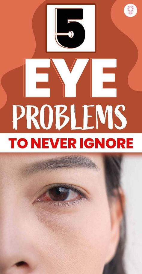 5 Eye Problems To Never Ignore: Irrespective of how many times our well-wishers and doctors tell us to go for an annual eye checkup, in a blink of an eye, we forget this advice. We tend to throw caution to the wind and continue to expose our eyes to screens and pollutants all day while paying no heed to their health whatsoever. #health #wellness #eyeproblems #healthcare Swollen Eyes, Eye Twitching, Eye Pain, Eyes Watering, Eye Problems, Eye Infections, Eye Exercises, Types Of Eyes, Home Doctor