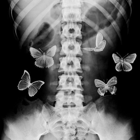 Ray Aesthetic, Xray Art, Collage Kunst, Fotografi Vintage, 흑백 그림, Butterfly Drawing, Tapeta Pro Iphone, Black Aesthetic Wallpaper, Butterfly Wallpaper