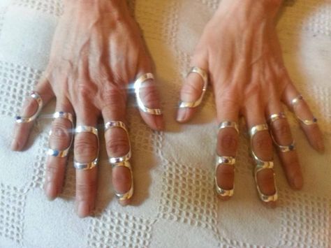 Elhers Danlos Syndrome, Trigger Finger, Tom Y Jerry, Medical Jewelry, Ehlers Danlos, Hand Therapy, Ehlers Danlos Syndrome, Two Rings, Joints Pain Relief