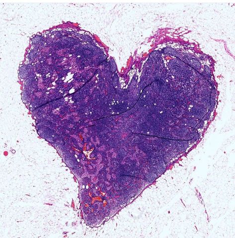 Love is everywhere, even in the lymph node Lymph Node, Love Is Everywhere, Find Love, Construction Paper, Beautiful Curves, Rocks And Crystals, A Heart, Heart Shapes, Medicine