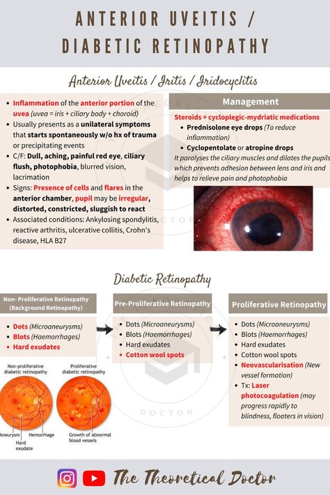 Explanation on anterior uveitis, iritis, iridocyclitis and explanation on the progression of diabetic retinopathy from non-proliferative retinopathy (background retinopathy) to pre-proliferative retinopathy and proliferative retinopathy. Optometry Notes Aesthetic, Optometry School Notes, Optometry Notes, Ophthalmology Notes, Ophthalmic Assistant, Opthalmic Technician, Optometry Education, Eye Medicine, Optometry School