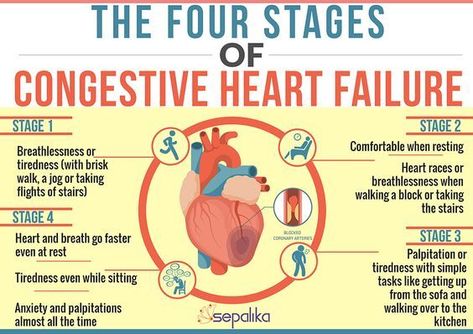 The Four Stages of Congestive Heart Failure #medicalschool #resources #medicalstudent - Image Credits: Sepalika Cardiovascular Notes, Abg Analysis, Chf Symptoms, Geriatric Nursing, Nurse Education, Np School, Cardiac Rhythms, Cardiac Nursing, Nursing Pins