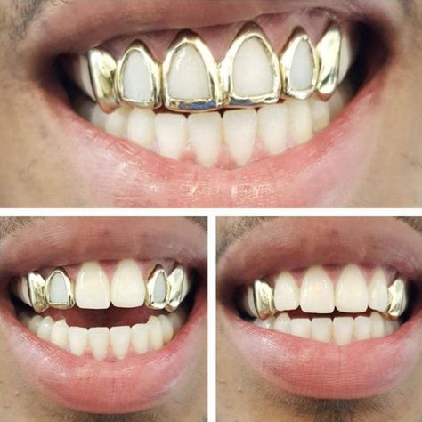 Silver Teeth Caps, Window Caps Teeth, Window Grillz Teeth, Female Grills Teeth Gold, Silver Caps On Teeth, Gold Caps Teeth, Grills Teeth Men, Silver Grillz Men, Grills For Women Teeth