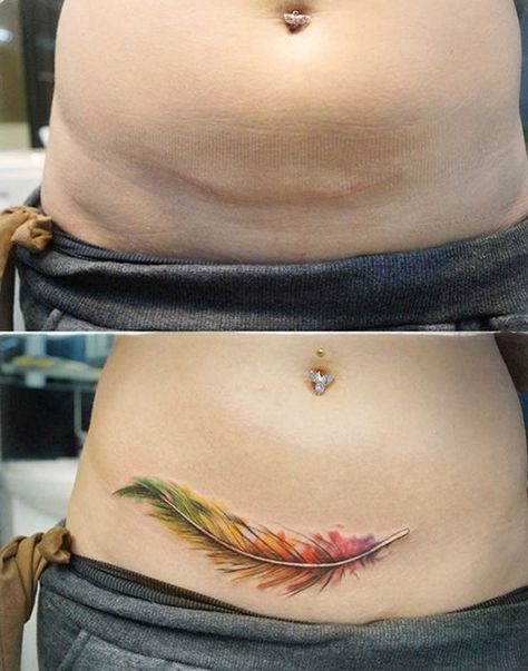 tatuaje para cubrir cicatriz de cesarea Tatuaje Cover Up, Mastectomy Tattoo, Coverup Tattoo, Tattoos To Cover Scars, Pink Tattoo, Scar Tattoo, Anklet Tattoos, Small Girl Tattoos, Stomach Tattoos