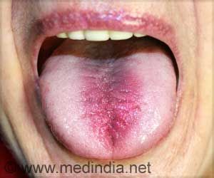 Burning Mouth Syndrome Needs More Rigorous Standards When Diagnosing Burning Mouth Disease, Burning Mouth, Burn Injury, Natural Lubricant, Dry Mouth, Holistic Care, Periodontal Disease, Chocolate Caliente, Hormonal Changes