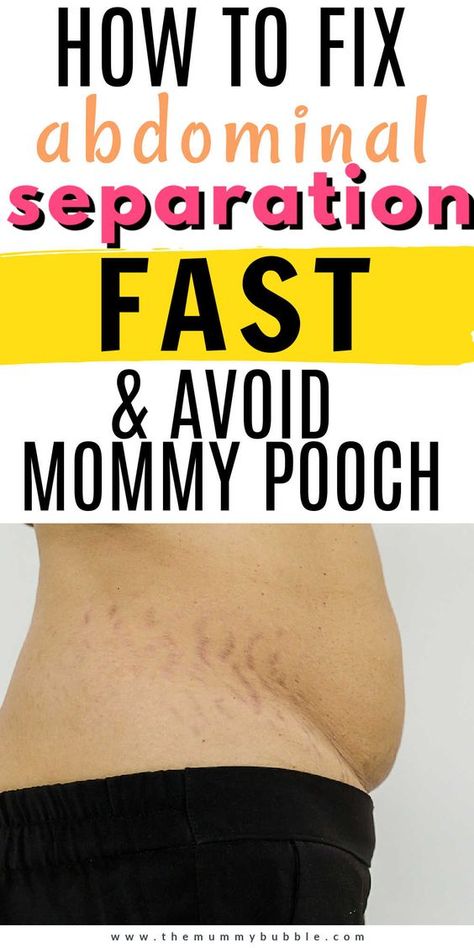 Exercises For After Birth, Losing Postpartum Belly, Abdominal Separation Diastasis Recti, Exercises For Abdominal Separation, Belly Muscles Workout, Postpartum Abdominal Exercises, Exercise After Birth, C Section Pooch Before And After, Mommy Pooch Exercises