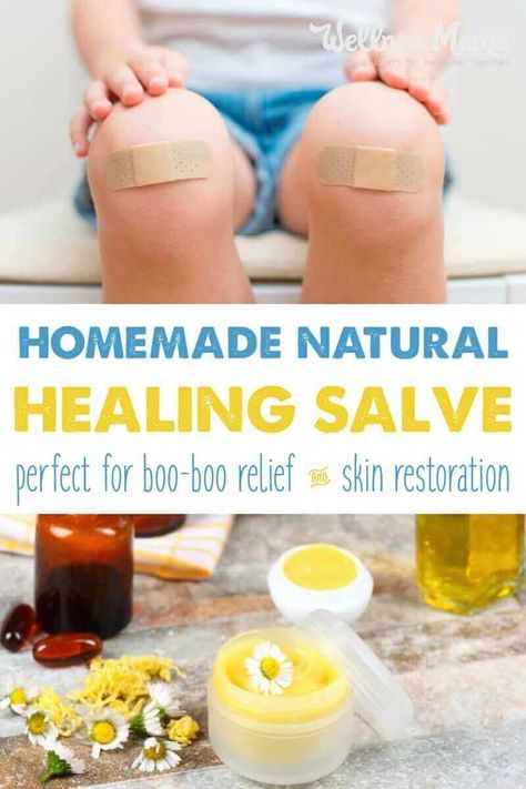 Homemade Antibiotic Ointment, Homemade Healing Salve, Homemade Antibiotic, Healing Salve Recipe, Best Cough Remedy, Homemade Cough Remedies, Toddler Cough Remedies, Dry Cough Remedies, Healing Salve