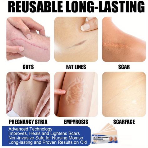 Faster shipping. Better service Lighten Scars, C Section Scars, Scar Reduction, Scar Removal Cream, Stretch Mark Removal, Cut Fat, Scar Removal, Scar Tissue, Skin Repair