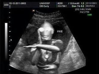 Ultrasound… Cant stop laughing! Pp Wa, Drama Memes, Cute Jokes, Jokes Pics, Funny Profile Pictures, Funny Reaction Pictures, Love Memes, Cartoon Jokes, Jokes Quotes