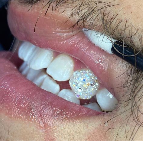 Teeth Jewelry Tooth Gems Men, Tooth Gems Aesthetic Men, Men’s Tooth Gems, Teeth Jewelry Men, Teeth Gems Men, Fairy Dust Tooth Gem, Tooth Gem Men, Tooth Gems Ideas Men, Tooth Gems Men