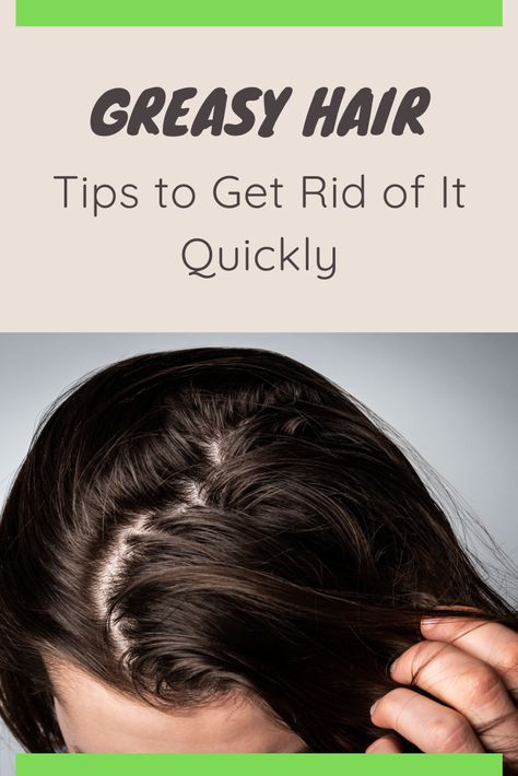 How To Help Greasy Hair, Greasy Bangs Fix, How To Fix Greasy Hair, Greasy Hair Tips, Fix Greasy Hair, Greasy Hair Hairstyles For Work, Greasy Hair Remedies, Prevent Greasy Hair, Bad Hairline