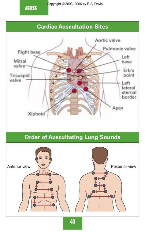 auscultation of lungs sounds - Google Search Auscultating Lung Sounds, Respiratory Therapist Student, Wound Care Nursing, Lung Sounds, Physical Therapy School, Nursing Assessment, Nursing School Essential, Nurse Study Notes, Nursing Mnemonics