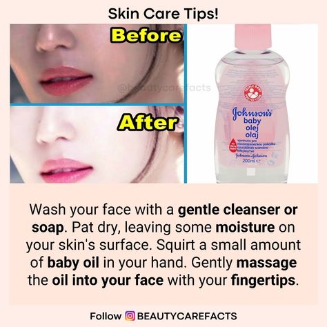 Get Crystal Clear Skin . . Follow beautycarefacts for natural beauty and health tips. . . Share with your friend👱👱‍♀️ or tag 😉 Double tap❤️ for more info🗣️ share + Tag your Friends. Follow beautycarefacts For Daily beauty and health remedies💯💯 #healthtipsforwomen #healthtipsdaily #healthtips #healthtipsoftheday #beautyremedies #beautycare #beautytips4you #homebeautytips #diybeautytips #naturalbeautytips #tipsbeauty #beautytips #healthremedies #healthylifestyle Crystal Clear Skin, Pimple Solution, Home Beauty Tips, Beauty And Health, Health Tips For Women, Beauty Remedies, Diy Beauty Hacks, Gentle Cleanser, Natural Beauty Tips