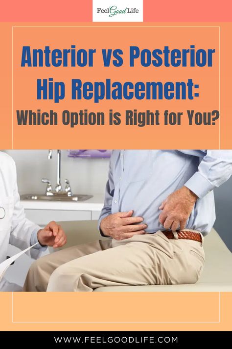 If you need hip replacement surgery, it's important to understand the differences between anterior and posterior approaches. Anterior hip replacement is less invasive and offers a quicker recovery time, while posterior hip replacement has been used for decades and is a tried and true option. In this article, we'll explore the pros and cons of each option and help you make an informed decision. #hipreplacement #anteriorhipreplacement #posteriorhipreplacement #orthopedicsurgery #healthcare Total Hip Surgery, Anterior Hip Surgery, Hip Precautions, Hip Operation, Hip Dislocation, Hip Surgery Recovery, Morning Yoga Stretches, Bursitis Hip, Hip Surgery