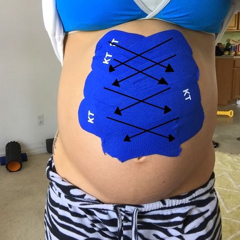 Prevent Diastasis Recti, Mommy Pooch, Diary Of A Fit Mommy, K Tape, Pregnancy Diary, Kinesio Taping, Muscle Abdominal, Mommy Workout, Pumping Moms