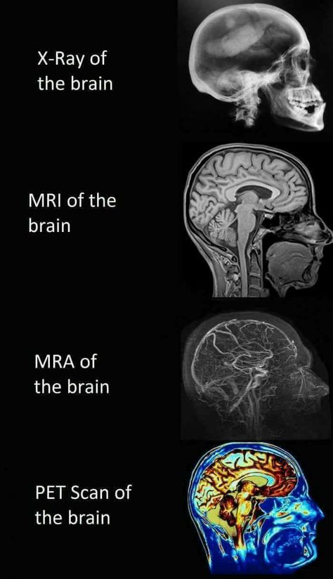 Tabel Periodik, Brain Images, Pet Scan, Medical Student Study, Nursing School Survival, Medical Facts, Nursing School Tips, Medical School Studying, Nursing School Notes