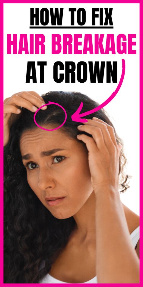 Discover the underlying causes, prevention strategies, and effective solutions for hair breakage at the crown. Achieve healthier and more harmonious hair with these actionable insights.