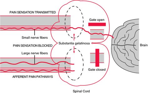 gate-control theory Loss Aversion, Control Theory, Medical Dictionary, Feminist Theory, Nerve Fiber, Nursing Process, Systems Theory, Acupuncture Points, Medical Terms