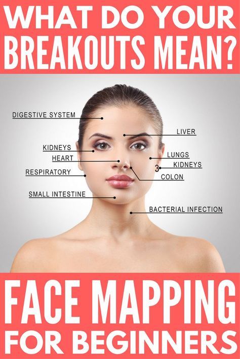 Your complete breakout map guide! If you haven’t heard of face mapping, take note! The location of your acne and breakouts isn’t random, it can actually tell you a lot about your health. If you struggle with bad skin and have exhausted all of the products and natural remedies that promise to get rid of acne without success, we’re sharing our best tips to help you understand what your breakouts mean and what you can do to control and (hopefully) eliminate them completely. Breakout Map, Doterra Acne, Gesicht Mapping, Face Mapping Acne, Bad Skin, Face Mapping, Natural Acne Remedies, Get Rid Of Acne, Natural Acne