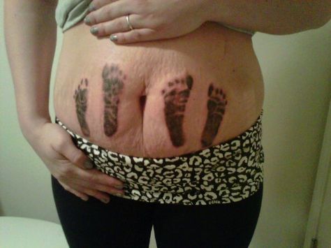 Stretch Mark Tattoos, Stretch Mark Tattoo, Bear Paw Tattoos, Paw Tattoos, Mark 9 23, Pictures Of Tattoos, Tummy Tattoo, Stretch Mark Remedies, Cute Tats