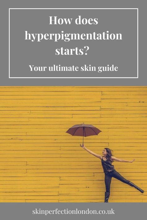 Have you noticed age spots, freckles, darkened patches or melasma appearing on your face? Are these pigmented patches even appear on your body like the upper back, arms, legs or buttocks? How does hyperpigmentation start? And what treatments are able to lift these or prevent them? Freckles On Arms, Skin Perfection, Age Spots, Laser Hair, Laser Hair Removal, Hair Removal, Skin, Hair