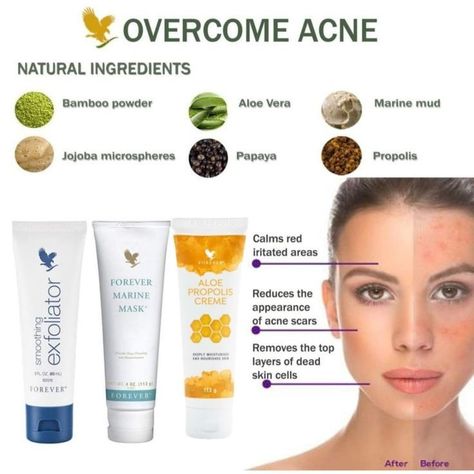 Aloe Propolis Cream, Aloe Heat Lotion, Aloe Vera Gelly, Forever Living Aloe Vera, Forever Products, Forever Business, Forever Aloe, Acne Solutions, Forever Living