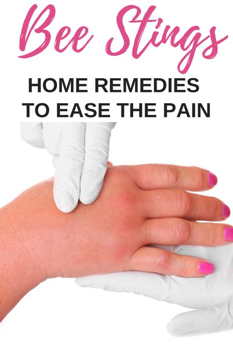 Getting stung by a bee, hornet, wasp, or yellow jacket HURTS.  Here are some home remedies to reduce swelling and take the 'ouch' out of getting stung by a bee! #outdoorliving #healthandwellness #naturelovers Natural Bee Sting Remedy, Bee Stings Relief Swelling, Wasp Sting Remedy Swelling, Bee Sting Remedy, Bee Sting Swelling, Bee Sting Relief, Wasp Sting Remedy, Swelling Remedies, Bee Repellent