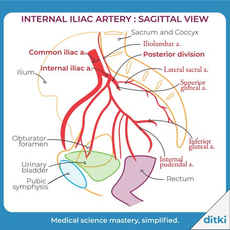 Internal Iliac Artery Branches, Iliac Artery, Internal Iliac Artery, Carotid Artery Anatomy, Right Coronary Artery Anatomy, Internal Carotid Artery Branches, Peripheral Artery, Arteries Anatomy, Airway Management