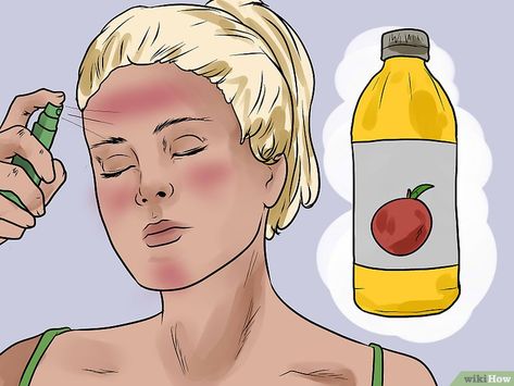 How to Prevent Skin Peeling After Sunburn: 14 Steps Sun Burn Remedy Face, Sunburn On Face, Sunburn Face, Sunburnt Face, Sagging Skin Remedies, Skin Peeling On Face, Burn Remedy, Sunburn Peeling, Burn Relief