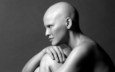 "I absolutely love and enjoy the woman I've become." Mom Photoshoot, Bald Beauty, Donne Calve, Bald Head Women, Shaved Head Women, Shave Her Head, Bald Girl, Bald Women, Close Shave