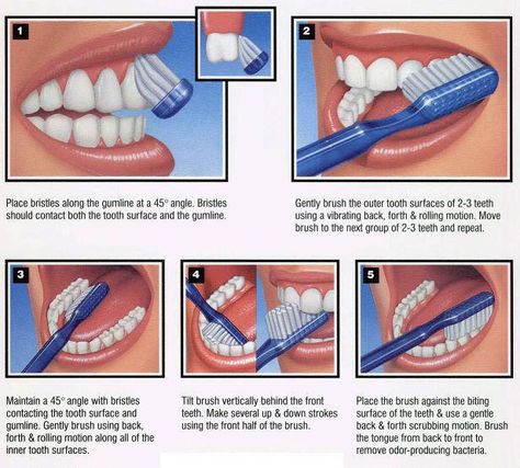 Brushing technique: Bass and Modified Bass Methods ~ MedchromeTube - Best Medical Videos Natural Teeth Whitening Diy, Dental Health Month, Teeth Whitening Diy, Dental Facts, Brush Your Teeth, Best Teeth Whitening, Teeth Care, Saint John, Dental Hygienist