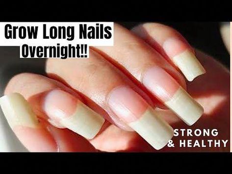 HOW TO GROW LONG NAILS FAST At Home DIY NATURAL NAIL GROWTH SERUM to Grow Long & Strong Nails (100% Works) Open For Details💕PRODUCTS MENTIONED:Lotion Linke... How To Get Long And Strong Nails, How To Have Long Healthy Nails, How To Grow Ur Nails In One Day, How To Grow Out Your Nails Overnight, How To Grow Your Nails With Vaseline, Grow Your Nails Faster Overnight, How To Get Longer Nails Overnight, How To Grow Your Nails Overnight, Mail Growth Tips