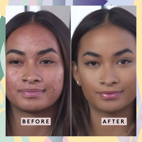 People are praising Fenty for this brilliant guide to covering acne Acne Fashion, Foundation Tutorial, Foundation Tutorials, Covering Acne, Fenty Beauty, Fashion Trend, Makeup Inspiration, Health And Beauty, Foundation