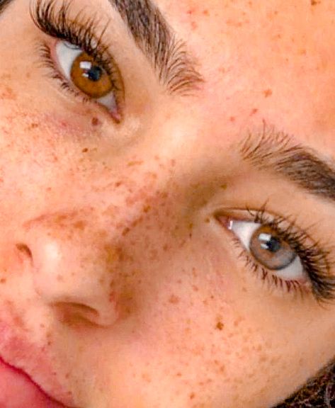 Stick And Poke Freckles, Soft Features Women, Freckle Pattern, Nose Freckles, Faux Freckles Makeup, Blonde Brown Eyes, Tattooed Freckles, Fake Freckles, Fair Skin Makeup