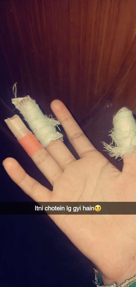 Finger Injury Fake Story, Hand Damage Dpz, Injury Snapchat Streaks, Blood Test Snapchat, Accident Hand Dpz, Cut Pic, Fake Injury, Snapchat Streak, Snap Streak