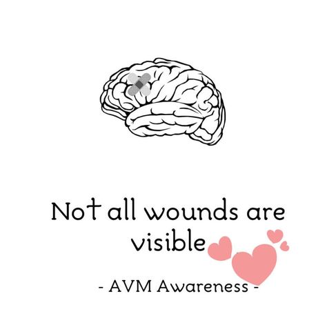 #brainaneurysms på Instagram | Hashtaggar Avm Awareness, Medical Emergency, Fetal Development, Blood Vessels, Go Fund Me, Need This, Brain, Instagram