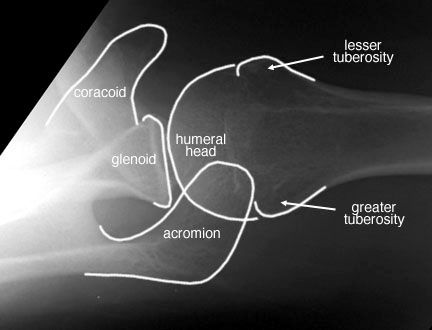 Lateral View Shoulder X-ray | Axillary View Shoulder Positioning Shoulder Xray, Xray Anatomy, Skeleton Shoulder, Dental Radiography, Dental X Ray, X Ray Machine, Radiology Schools, Medical Radiography, Shoulder Anatomy