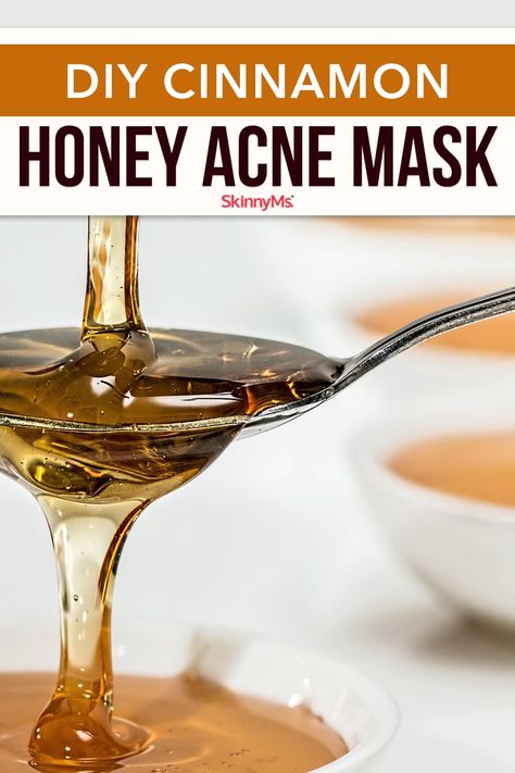 Honey Acne Mask, Cinnamon Face Mask, Exercise Band Workout, Lose Belly Fat Exercise, Exercises For Back Fat, Mask For Blackheads, Belly Fat Exercise, Exercise To Lose Belly, Face Mask Acne