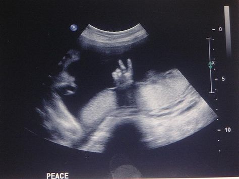 Peace on Earth... Boy Ultrasound, Funny Baby Boy, Baby Ultrasound, Ultrasound Pictures, Anak Manja, Ultrasound, Nursery Rhymes, Funny Babies, Beautiful Photography