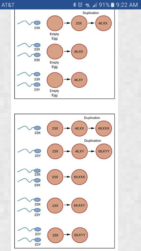 Gestational Trophoblastic Neoplasia, Hytadidiform mole Top diagram of complete molar pregnancy and bottom of partial Molar Pregnancy, Pregnancy Art, Pregnancy Quotes, Pregnancy Symptoms, Ultrasound, Rainbow Baby, Mole, I Hope, Rainbow