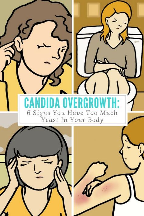 Yeast Infection Symptoms, Candida Cleanse, Candida Overgrowth, Candida Yeast, Yeast Infections, Candida Diet, Natural Health Tips, Natural Therapy, Strong Motivation