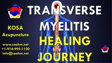 Transverse Myelitis and Multiple Sclerosis are the typical indications of an unhealthy liver and can easily and successfully be treated once the liver is adequately treated. The detoxifying liver is ineffective and based on incorrect understanding. Transverse Myelitis, Detoxifying Liver, Mid Back Pain, Accident Injury, Acupuncture Points, Healthy Liver, The Liver, Silver Bullet, Healing Journey