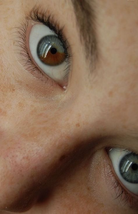 Sectoral Heterochromia, Pretty Eyes Color, Heterochromia Eyes, Rare Eye Colors, Eyes Contact, Coloured Lenses, Rare Eyes, Head Anatomy, Beautiful Eyes Color