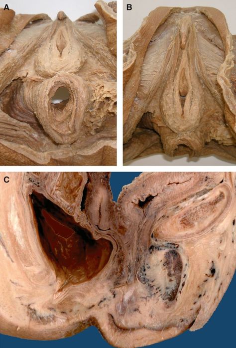 Human Body Anatomy Aesthetic, Mammary Gland Anatomy, Human Anatomy Organs, Human Body Exhibit, Pelvic Diaphragm, Female Reproductive System Anatomy, Female Reproductive Anatomy, Human Anatomy Female, Inside Human Body