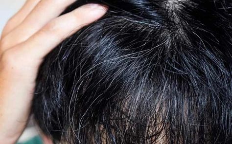 How To Reverse Your Premature Grey Hair With Ayurveda? – Vedix Premature Grey Hair Styles, Matted Hair Severely, Prevent Grey Hair Naturally, How To Reverse Grey Hair Naturally, Remedies For Premature Grey Hair, Grey Locks, Grey Hair Reversal, Greying Hair, Reverse Gray Hair