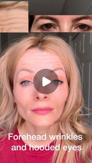 Hide Forehead Wrinkles, Lift Eyebrows, Remove Forehead Wrinkles, Repeat Daily, Health Fitness Nutrition, Forehead Wrinkles, Natural Body Care, Face Yoga, Hooded Eyes