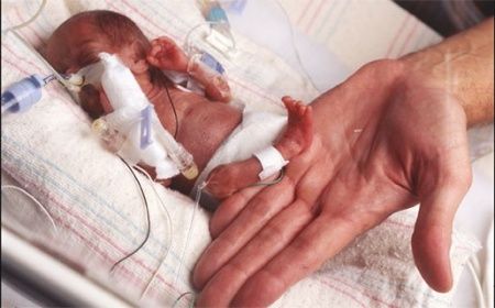 Prematuur World Prematurity Day, Pregnancy Facts, Gestational Age, Premature Birth, Neonatal Nurse, Preemie Babies, Premature Baby, Nicu Nurse, We Are The World