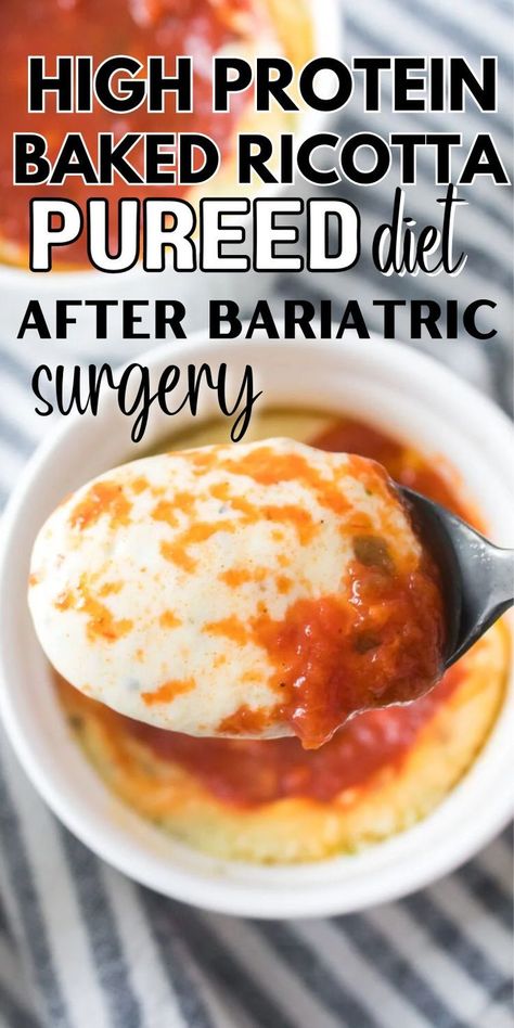 Easy baked ricotta perfect for gastric surgery patients as it's high in proteins and is a good pureed diet after bariatric surgery. It's creamy and delicious making each bite a delight! Sleeve Surgery Diet, Ricotta Bake, Bariatric Recipes Sleeve Liquid Diet, High Protein Bariatric Recipes, Gastric Surgery, Pureed Diet, Liquid Diet Recipes, Bariatric Recipes Sleeve, Gastric Bypass Recipes