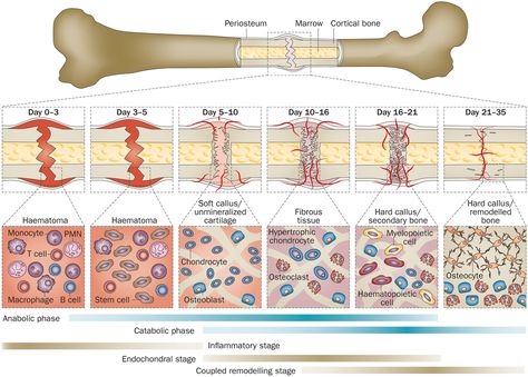 Tissue Biology, Fracture Healing, Bone Healing, Nurse Practitioner School, Medicine Studies, Sports Therapy, Biomedical Science, Musculoskeletal System, Medical School Essentials