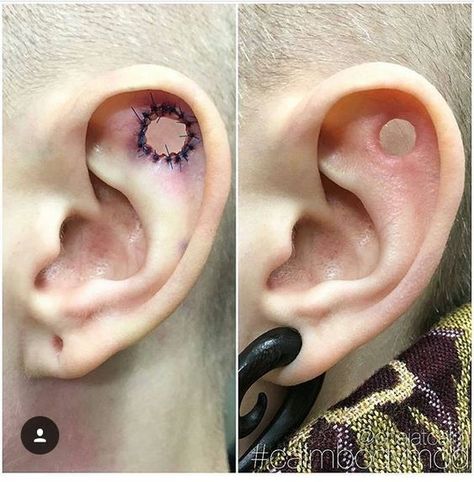 #BEAUTY ,#REALATIONSHIPS #Fashion #Outfits #Winter Outfits #Animals Stretched Conch, Outer Conch, Ear Tattoo Ideas, Mod Jewelry, Ear Tattoos, Piercing Inspo, Stretched Lobes, Unique Faces, Ear Ring